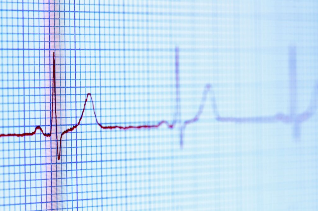 heartbeat